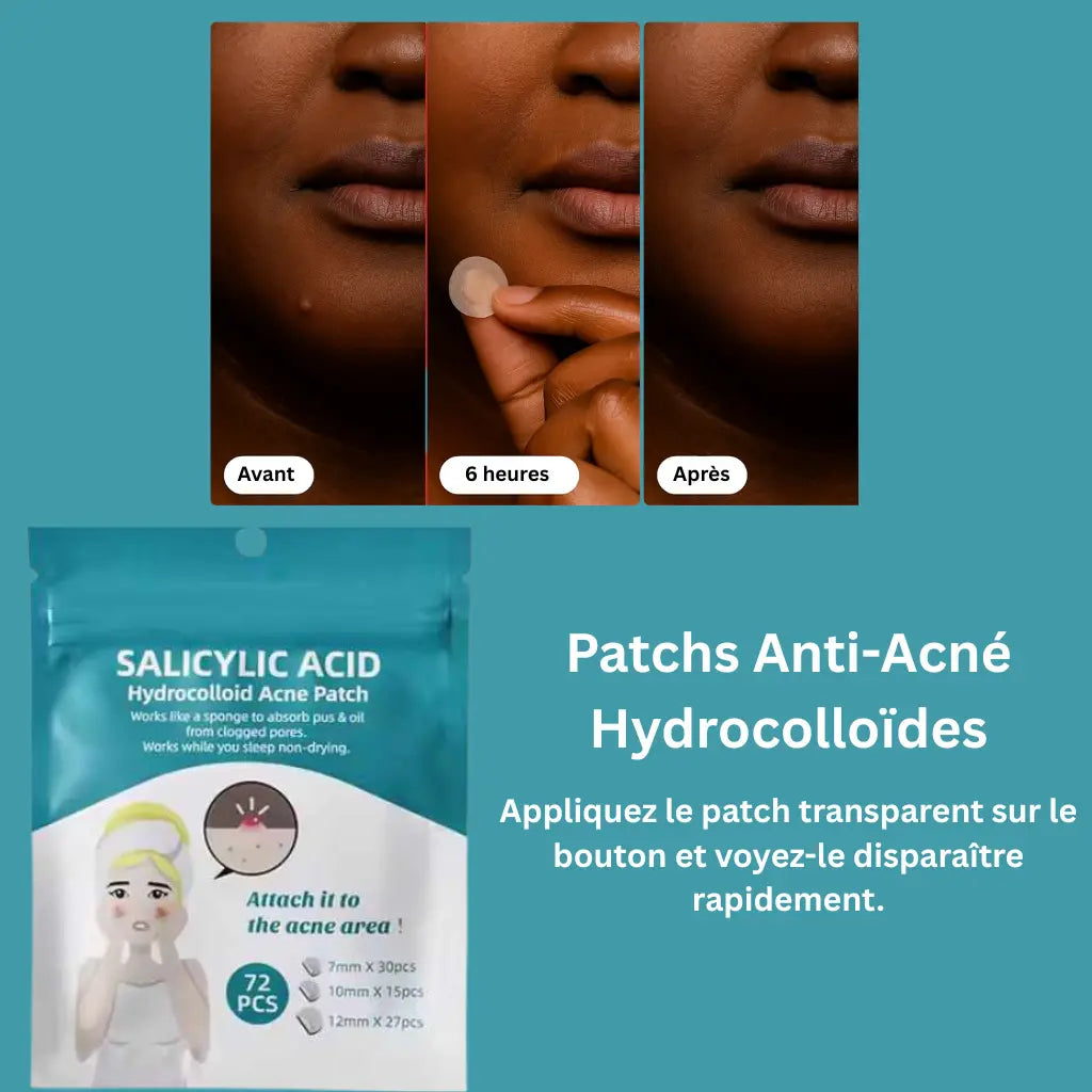 Patchs Anti-Acné Hydrocolloïdes - NUTRAFRIK